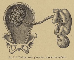 Corte transversal de un útero mostrando la placenta, el cordón umbilical y el bebé de German School